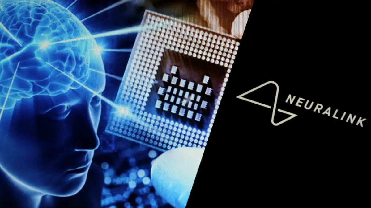 Neuralink Masuk Fase Produksi Massal, Operasi Otak Kini Full Otomatis